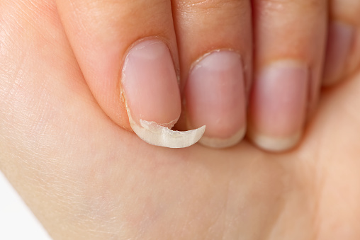 The Easiest way to Fix Broken Nail or Cracked Acrylic Nails - Ultra Beautify