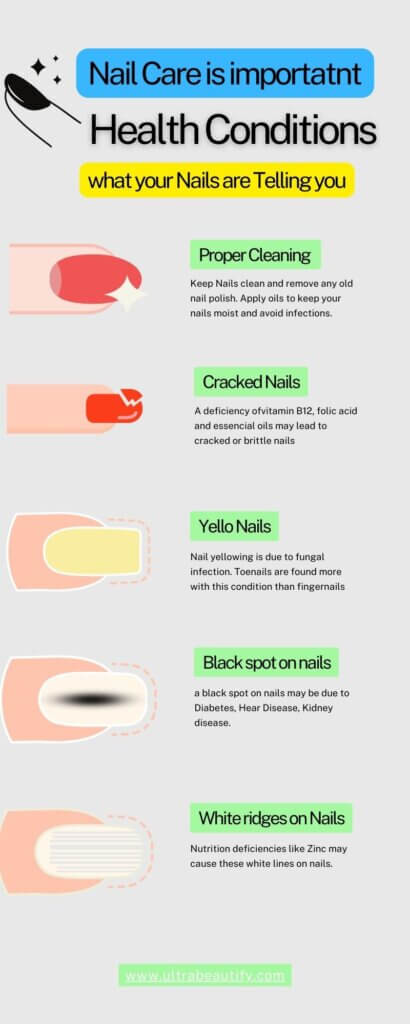 why nail care is important infographic